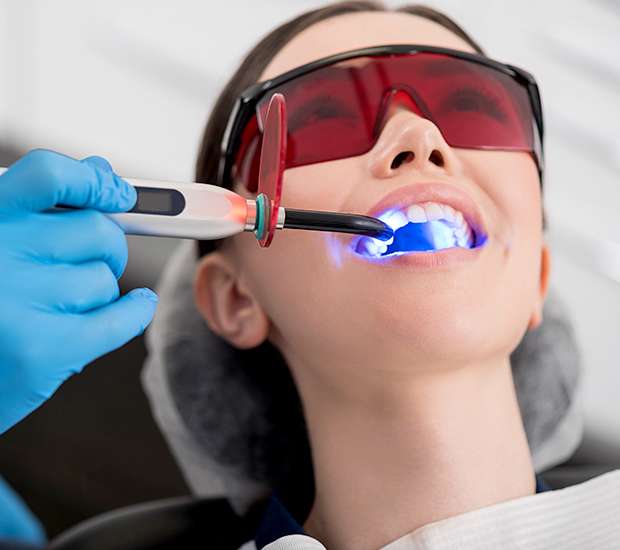 Bakersfield Professional Teeth Whitening
