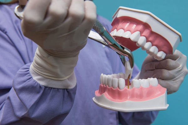 A Step By Step Guide To A Tooth Extraction Procedure